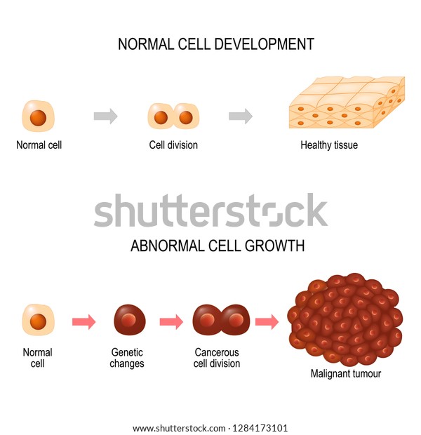 Cancer Cells Illustration Showing Cancer Disease Stock Vector (Royalty ...