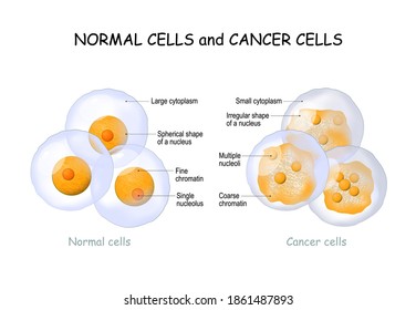 Cancer cells and Normal cells. comparison and difference between healthy tissue and tumor. details about chromatin, nucleus and cytoplasm.