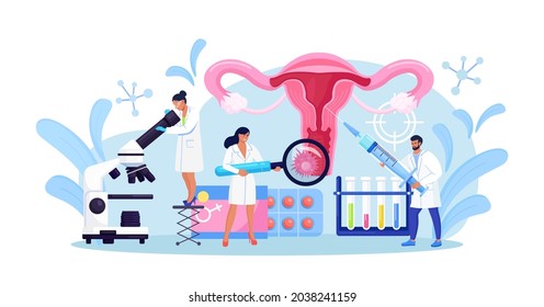 Cancer of cervix, papillomavirus. Tiny doctors examine uterus with magnifier to treat cervical cancer,  cauterize erosion, diagnosis papilloma. HPV vaccination. Gynecology, female disease