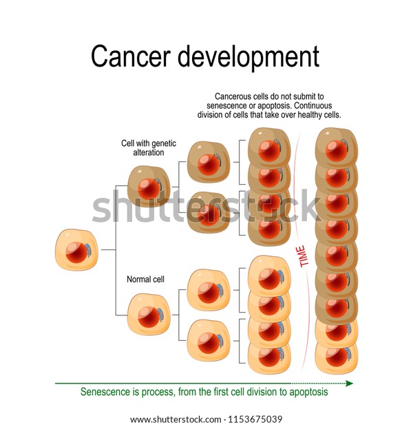 Cancer Development. Cancerous cells do not submit to\
senescence or apoptosis. Сontinuous division of cells that take\
over healthy cells. Vector diagram for educational, science and\
medical use