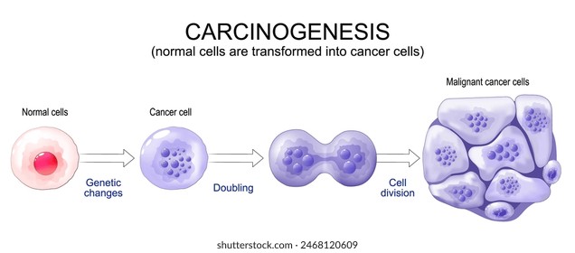 Cancer development. Normal cells are transformed into cancer. Carcinogenesis from Genetic mutations in healthy cell to Malignant cancer cells. Mutagenesis, Oncogenesis, tumorigenesis. Tumor formation