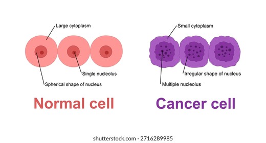 Desarrollo del cáncer. Las células normales se transforman en cáncer. Carcinogénesis de mutaciones genéticas en células sanas a células cancerosas malignas. Mutagénesis, oncogénesis, tumorigénesis. Formación de tumores