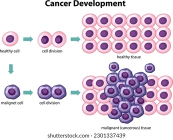 Cancer Development vector with information illustration