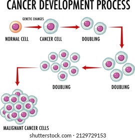 Cancer Devlopment Process infographic  illustration