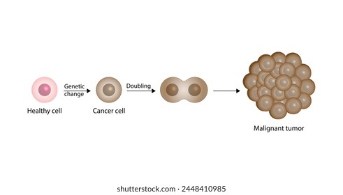 Cancer disease development. Malignant tumor. Medical biological, scientific vector illustration.	