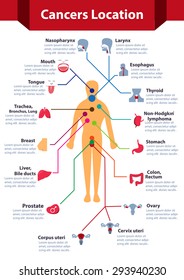 Cancer infographics, Cancer location on human body map with colorful style