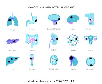 Cancer in Internal organs. Oncology clinic logo. Tumor in human body. Liver, intestine, bladder, and other organs with neoplasm medical icons. Pain and inflammation anatomical flat vector illustration