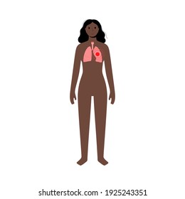 Cancer or lungs disease . Pneumonia, tuberculosis, asthma concept. Inflammation in respiratory system. Human internal organs exam. Adult black woman character poster. Pain in chest vector illustration