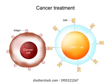 Cancer Treatment And CAR T-cell Therapy. Chimeric Antigen Receptor T Cells. CAR T Cells. Vector