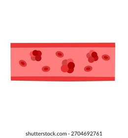 cancer tumor cell developing concept	