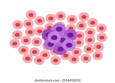 cancer tumor cell disease concept