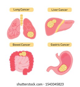 Cancer types flat vector illustration.