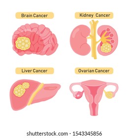 Cancer types flat vector illustration.
