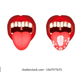 Human Mouth Opened Show Teeth Gum Stock Vector (Royalty Free) 744118066