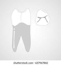 canine tooth anatomy or treatment 