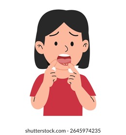 canker sore in mouth. vector illustration