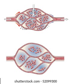 Capillary Bed Showing Lymphoedema