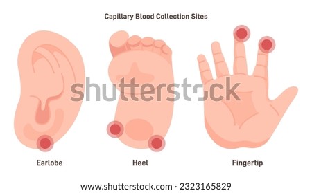Capillary blood sampling sites. Collection of capillary blood from a fingertip, heel and earlobe. Blood test medical diagnosis procedure. Flat vector illustration