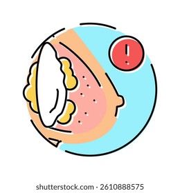 capsular contracture surgery color icon vector. capsular contracture surgery sign. isolated symbol illustration