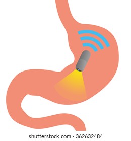 Capsule endoscopy and wireless communication, vector illustration