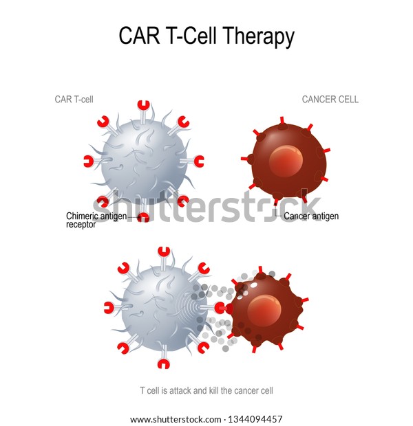 CAR T immunotherapy. Artificial T cell receptors are\
proteins that have been engineered for cancer therapy (killing of\
tumor cells). genetically engineered. Vector diagram for medical\
and science use