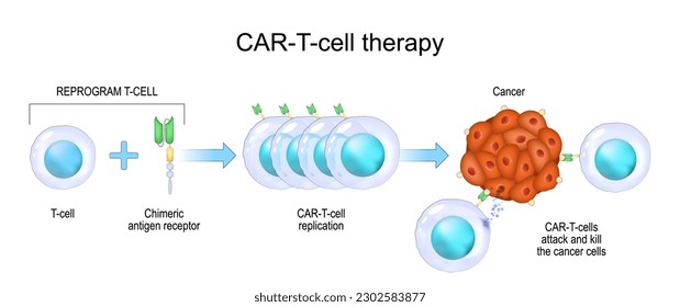 CAR T-cell therapy. cancer immunotherapy. killing of tumor cells. genetically engineered. Personalized medicine. Vector illustration