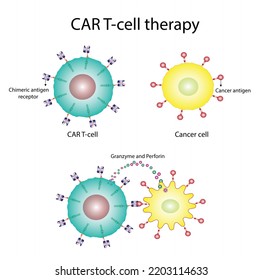 CAR T-cell Therapy And Cancer Treatment . Cancer Therapy. CAR T Cells Immunotherapy.  Chimeric Antigen Receptor T Cells. T Cell Receptor Proteins That Have Been Engineered To Kill Cancer Cells. Vector