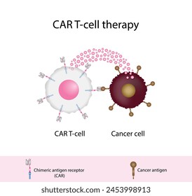 Terapia con células T CAR y tratamiento del cáncer. Células T receptoras de antígeno quimérico. Proteínas receptoras de linfocitos T que han sido modificadas para destruir las células cancerosas. Inmunoterapia con células T CAR. Terapia contra el cáncer. 