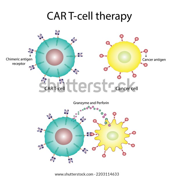 CAR T-cell therapy and Cancer treatment . Cancer\
therapy. CAR T cells immunotherapy.  Chimeric antigen receptor T\
cells. T cell receptor proteins that have been engineered to kill\
cancer cells. Vector