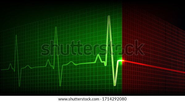 心停止と再び心臓鼓動 心拍数グラフ 心電図アイコン波 心電図 赤と緑 3dベクターイラスト のベクター画像素材 ロイヤリティフリー