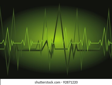 Cardiac curve
