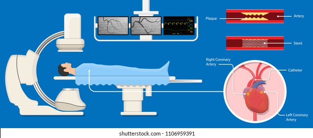 Heart Catheterization Images Stock Photos Vectors Shutterstock