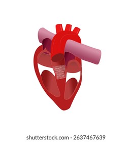 Cardiac model of Transcatheter aortic valve implantation (TAVI)