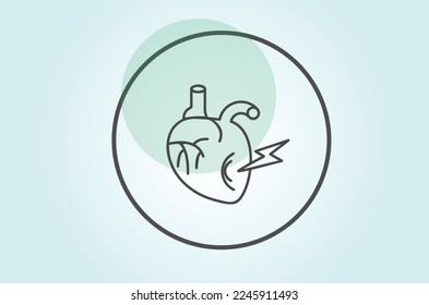 Cardiac surgery, or cardiovascular surgery, is surgery on the heart or great vessels performed by cardiac surgeons