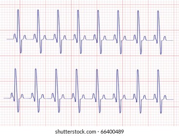 cardiogram