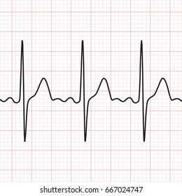 Cardiogram. Electrocardiogram. Graphic representation of heart work . Health and medicine. Vector illustration.