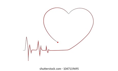 cardiogram of the heart