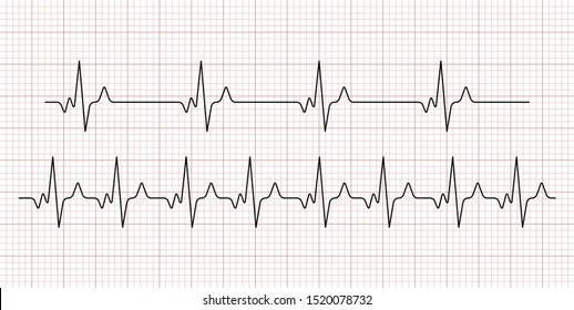 Cardiogram. Heart beat. Heartbeat line. Electrocardiogram. Vector 