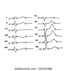 Cardiogram. Heartbeat. Schedule. Vector illustration on isolated background.