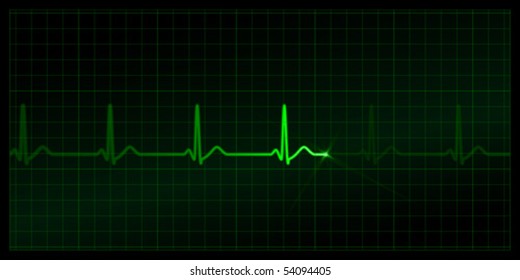 Cardiogram on the monitor. Green heartbeat line at black background. Vector medicine Illustration