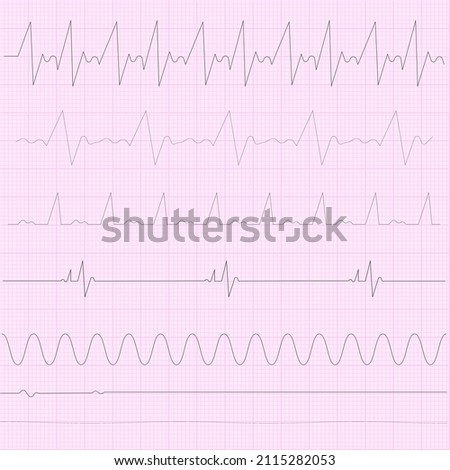Cardiogram paper. Cardiac pulse icon. Heart beat. Cardiology ign. Medicine concept. Vector illustration. Stock image. 