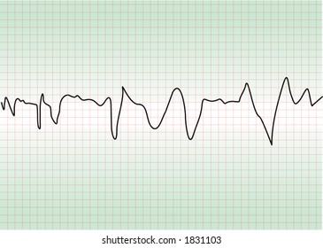 cardiology test
