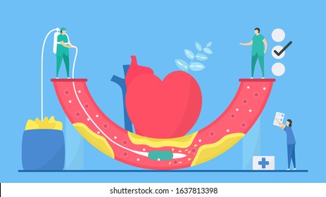 Cardiology vector illustration. Atherosclerosis is disease that plaque builds up inside arteries. Blood vessel is narrow and hard because fat, cholesterol, and calcium.