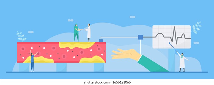 Cardiology Vector Illustration. Atherosclerosis Is Disease That Plaque Builds Up Inside Arteries. Blood Vessel Is Narrow And Hard Because High Level Of Fat And Cholesterol.