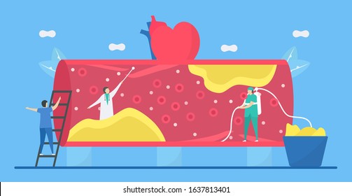 Cardiology vector illustration. Atherosclerosis is heart disease that plaque builds up inside arteries. Blood vessel is narrow and hard because fat, cholesterol, and calcium.