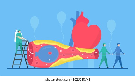 Cardiology vector illustration. This disease is narrowing of coronary arteries. Balloon angioplasty uses to improve blood flow of vessel.