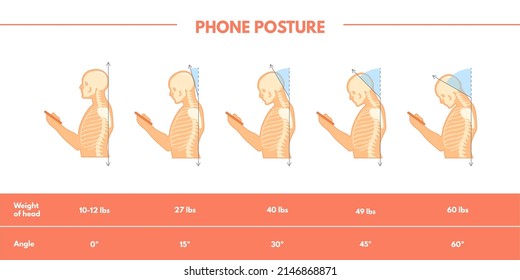 Care neck posture. Spine pain position with phone, correct standing head for anatomy health painful moving bone back muscle, mobile addiction, angle human necks, vector. Illustration incorrect posture