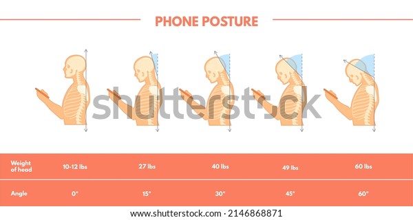 Care neck posture. Spine pain position with\
phone, correct standing head for anatomy health painful moving bone\
back muscle, mobile addiction, angle human necks, vector.\
Illustration incorrect\
posture