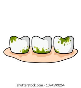 Caries and dental problems. Dentistry and sick dirty teeth with stains. Oral hygiene. Medical care. Gingivitis. The need for cleaning. Tooth decay. Cartoon illustration