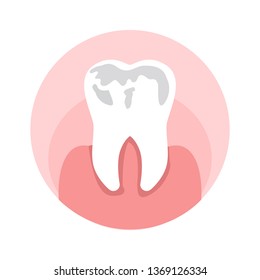 Caries, Holes in Tooth Flat Vector Illustration. Dental Sickness Symbol, Stomatology Clinic. Damaged Enamel, Toothache, Cavities Treatment, Dentistry Service. Orthodontic Diagnosis Center